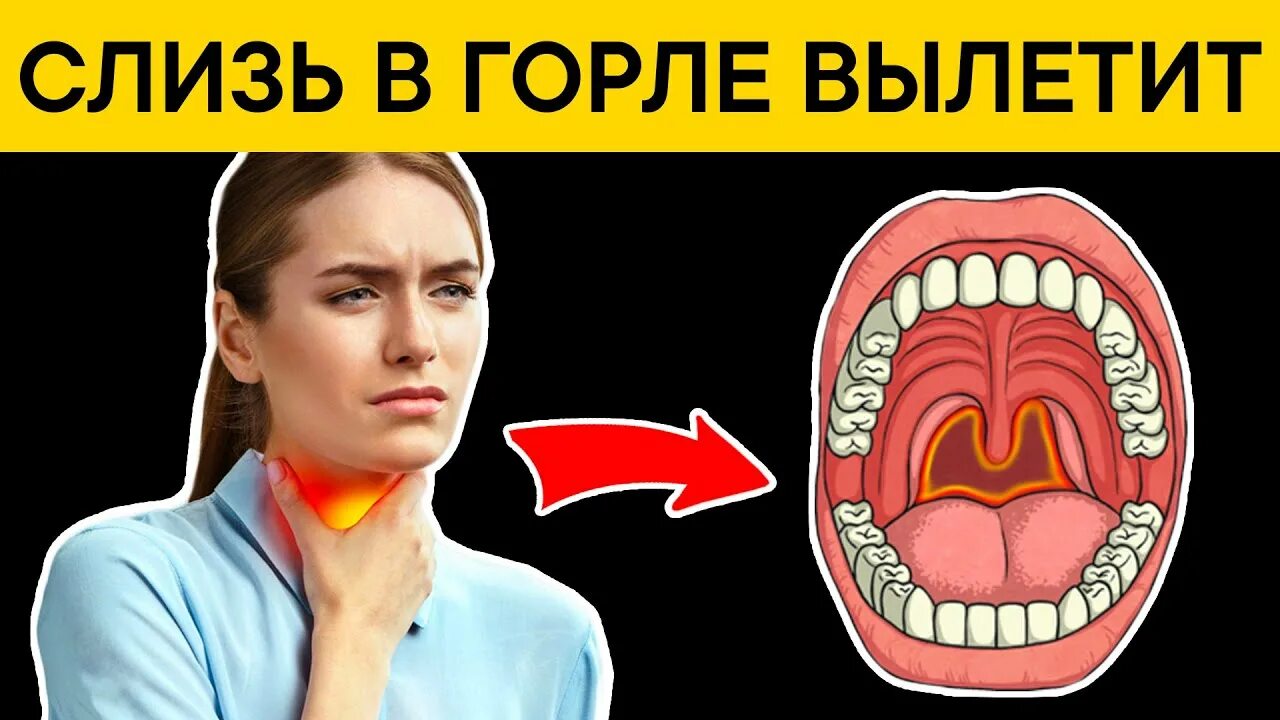 Как убрать мокроту из горла. Скапливание слизи в горле.