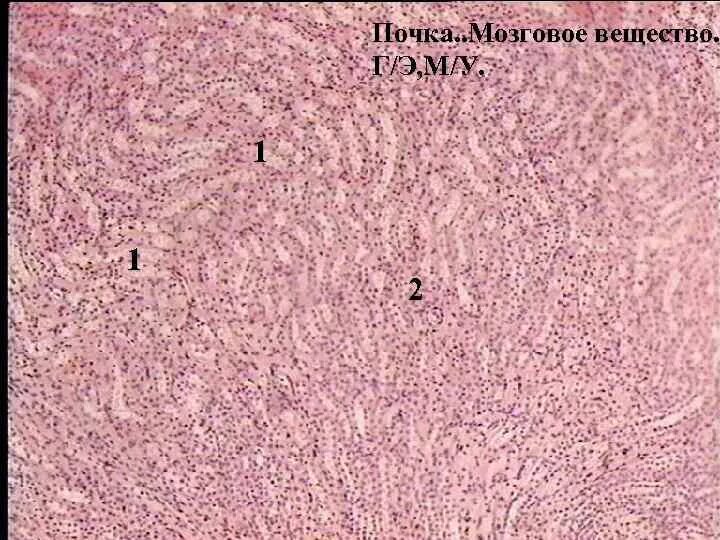 Почках и в головном мозге. Корковое вещество почки гистология. Мозговое вещество почки гистология. Мозговое вещество почки гистология препарат. Корковое и мозговое вещество почки гистология.