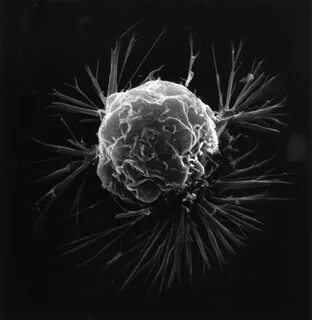 Cancer cell