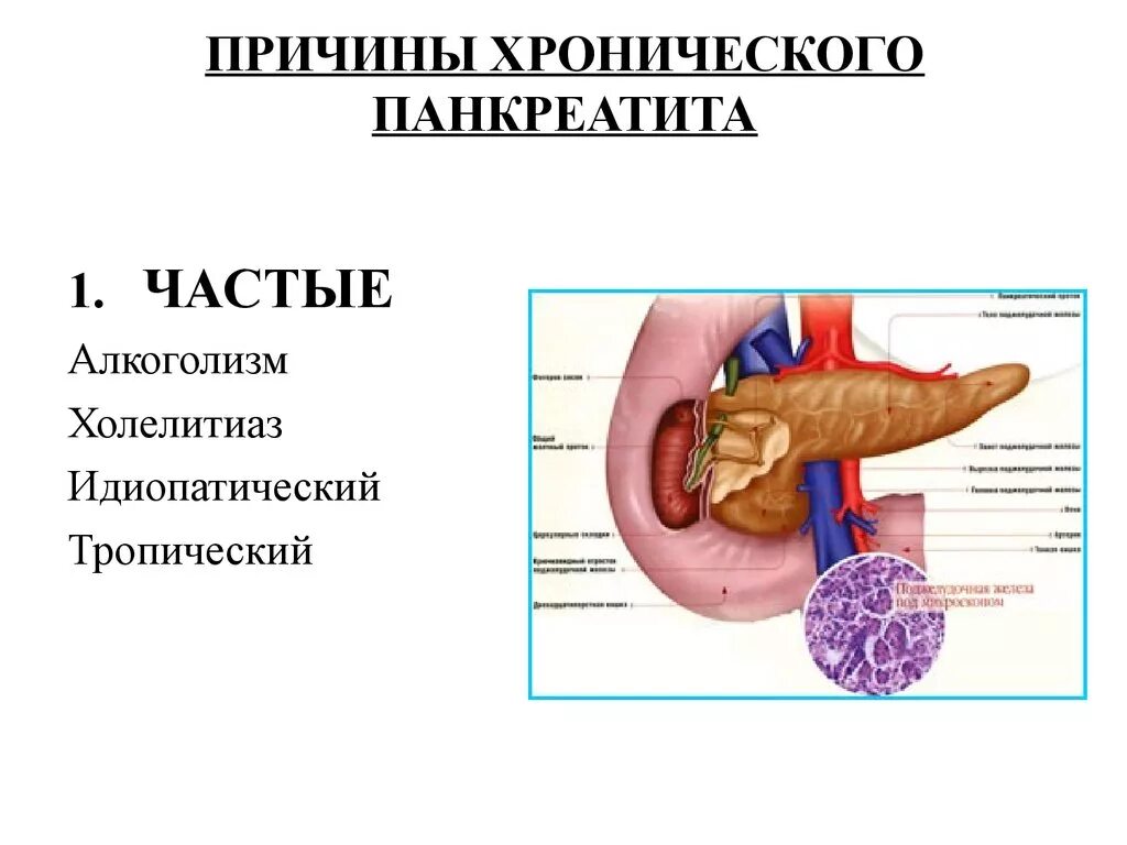 Панкреатит причины заболевания. Хронический панкреатит. Хронически йпанкреотит. Хронический панкреатит поджелудочная железа.