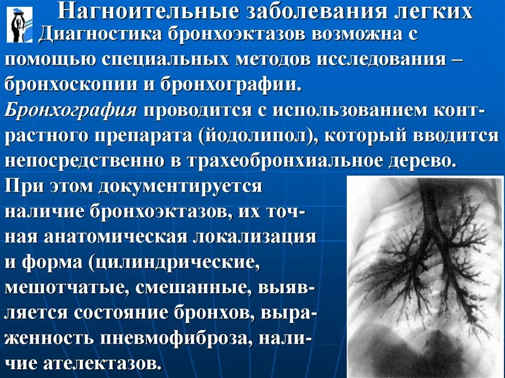 Диагнозы заболевания легких. Нагноительные заболевания легких. Заболевания легких названия. Диагностика заболеваний лёгких. Методы диагностики нагноительных заболеваний легких.