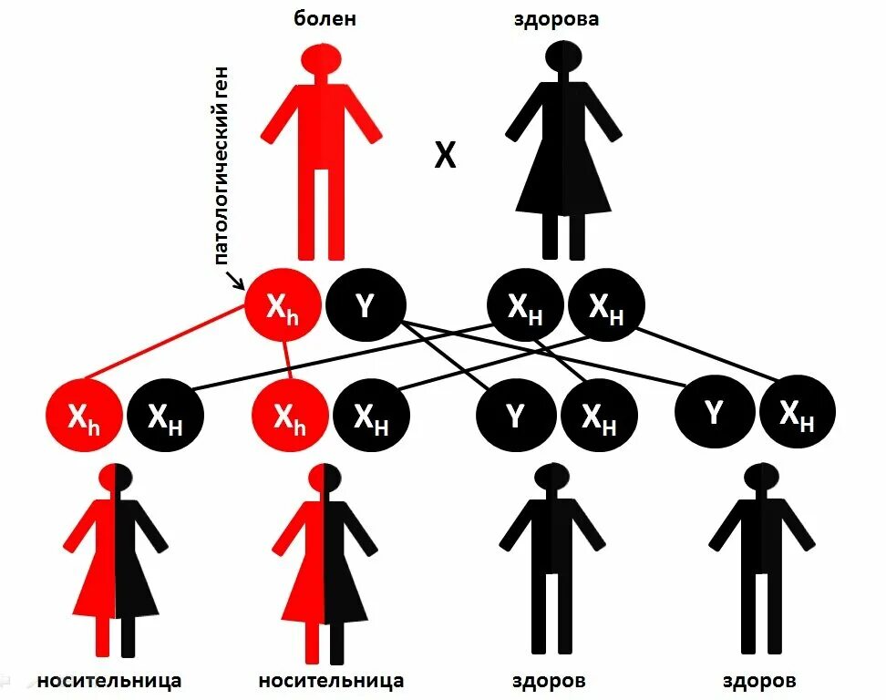 Гены детей от первого мужчины. Схема наследования гемофилии. Схема передачи гемофилии по наследству. Гемофилия передается по наследству. Гемофилия Тип наследования.