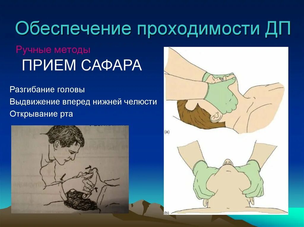Выдвижение вперед
