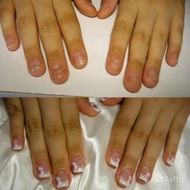 маникюр на обгрызанные ногти без наращивания. маникюр на короткие обгрызанные ногти. наращивание ногтей на обгрызанные ногти. наращивание на обгрызенные ногти. маникюр нагрызаные ногти.