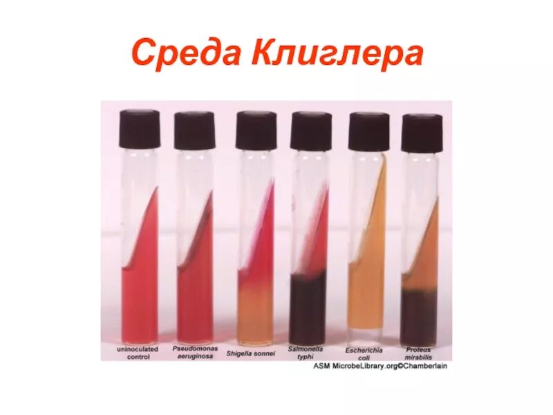 Среда разложения. Рост сальмонелл на среде клиглера. рост шигелл на среде клиглера. среда клиглера сальмонеллы. среда клиглера шигеллы.