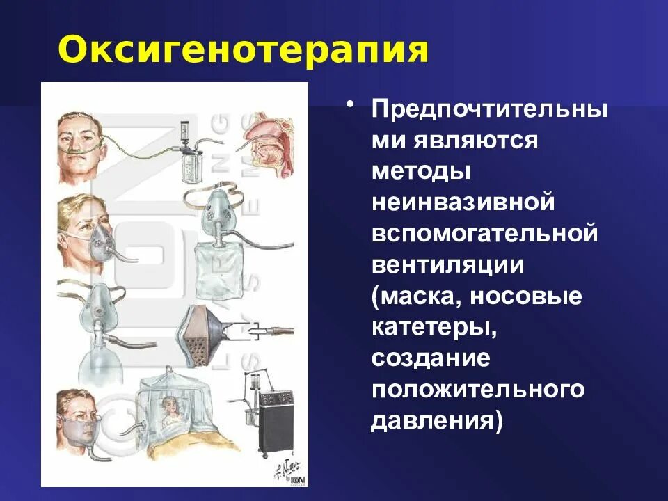 Подача кислорода алгоритм. Оксигенотерапия. Методы оксигенотерапии. Проведение оксигенотерапии. Оксигенотерапия алгоритм.