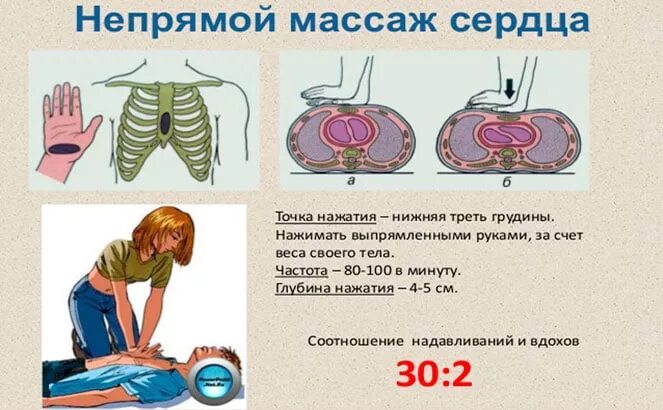 Что такое непрямой массаж сердца. Схема проведения непрямого массажа сердца. алгоритм оказания непрямого массажа сердца. алгоритм проведения наружного непрямого массажа сердца. проведение наружного массажа сердца алгоритм.