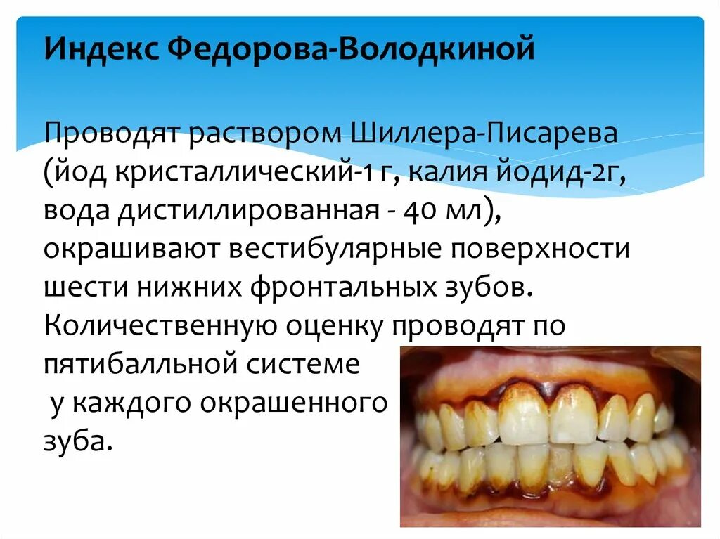 Индекс десна. Окрашивание зубов раствором Шиллера Писарева. Федоровой Володкиной индексные зубы. Зубные отложения презентация. Индекс Федорова брлоткиной.