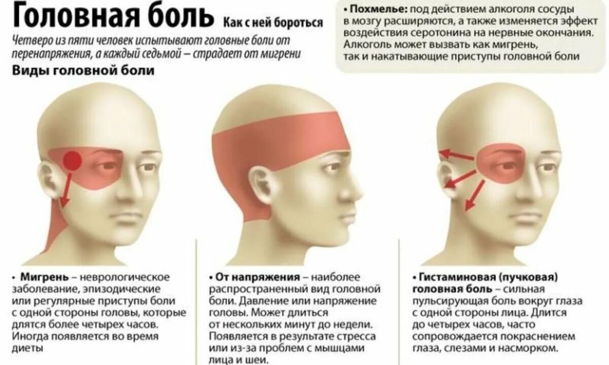 При нагрузке болит голова. Виды головной боли. Локализация глазной боли. Причины головной боли. Боль в висках головы.