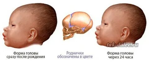 Рост головы 1 месяц