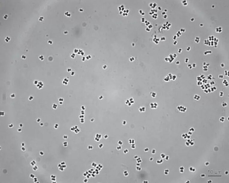 Kocuria kristinae. Micrococcus Agilis. Micrococcus kristinae. Микрококки микроскопия. Rothia mucilaginosa