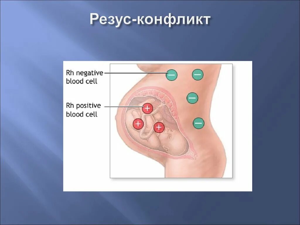 Резус-конфликт гистология. Резус фактор и резус конфликт. Резус конфликт физиология. Резус конфликт картинки. После резус конфликта