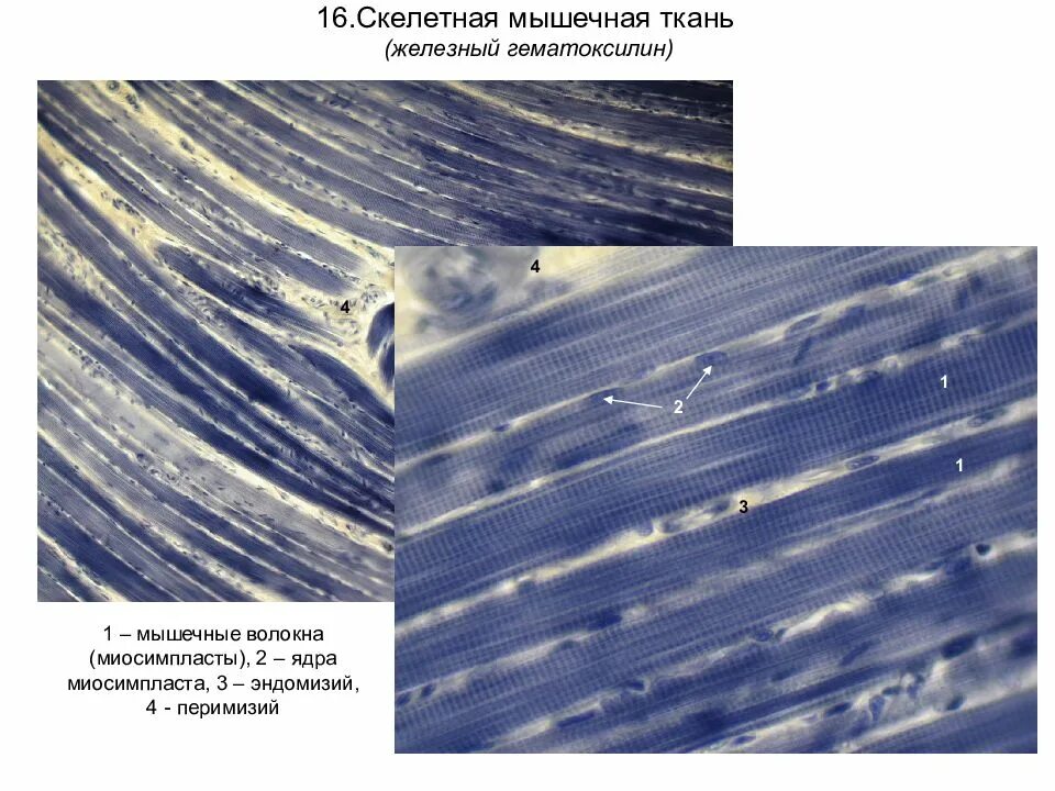 Поперечно полосатая мышечная ткань Железный гематоксилин гистология. Поперечно полосатая мышечная ткань окраска Железный гематоксилин. Поперечно-полосатая мышечная ткань препарат гистология. Поперечнополосатая Скелетная мышечная ткань Железный гематоксилин. Препарат поперечно полосатая мышечная ткань