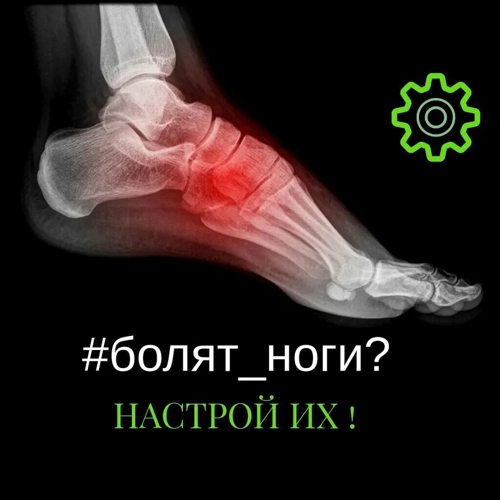 Фасциит подошвенного апоневроза. Остеофит пяточной кости. Голеностопный сустав анатомия строение мышцы. Болит нога в середине стопы. Болит нога в середине стопы.