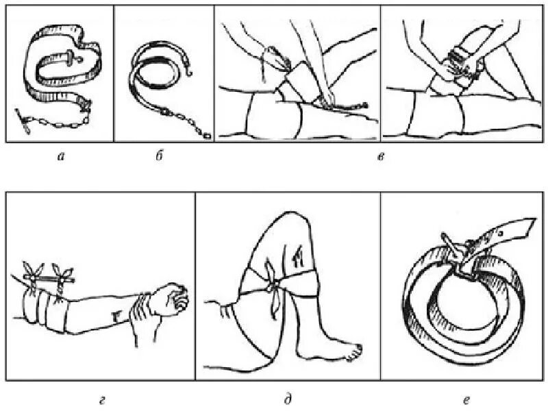 Артериальное кровотечение. Наложение кровоостанавливающего жгута. Наложение артериального жгута рисунок.