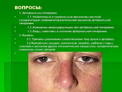 Гиперимия это