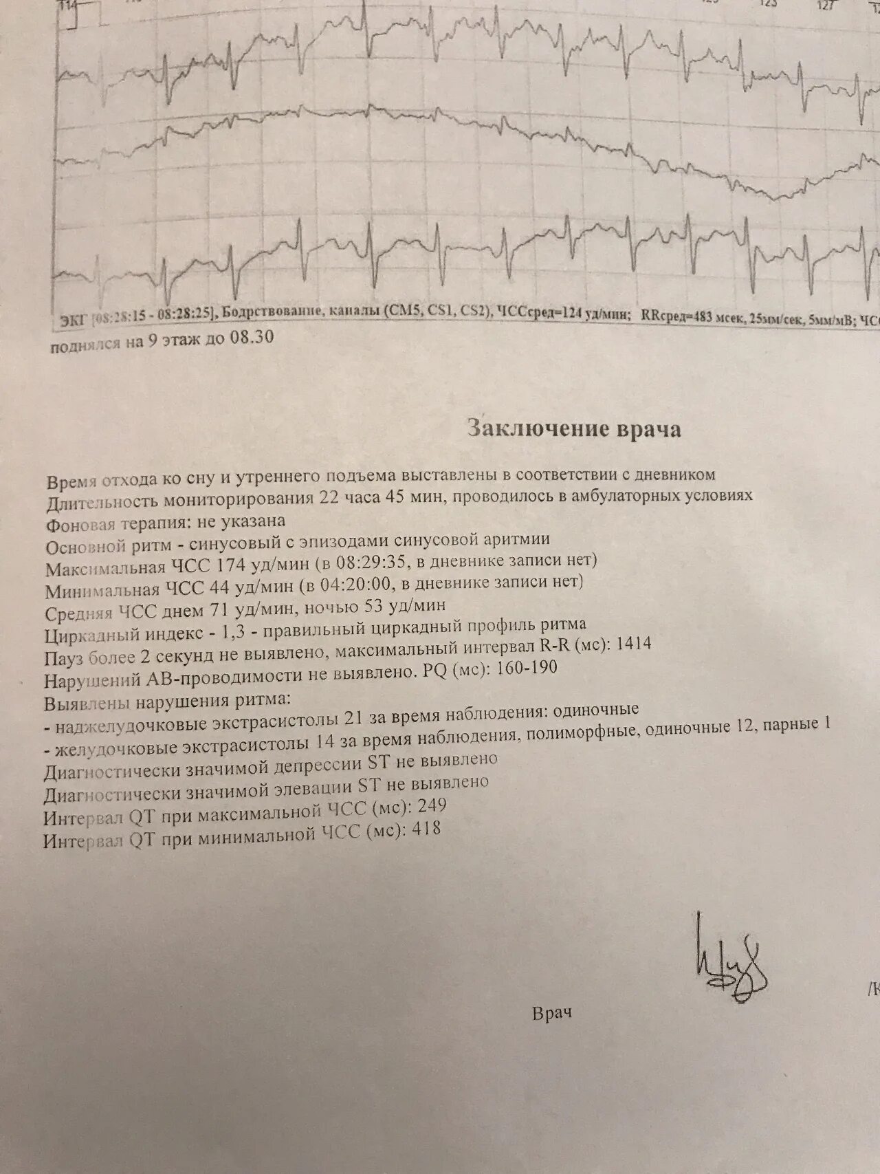 Циркадный индекс норма у женщин. Циркадный индекс чсс норма. Циркадный индекс 1 1. Суточный индекс. Циркадный индекс 1 1.