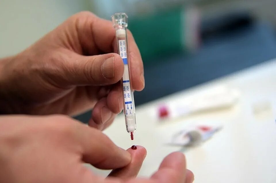 Тест на ВИЧ. Экспресс тест на ВИЧ. Тест на ВИЧ фото. Тест на ВИЧ по крови из пальца.