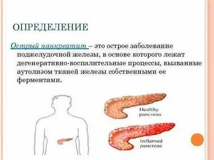 Панкреатопатия