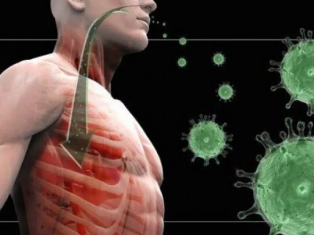 Тяжелые вирусные. Тяжелый острый респираторный синдром симптомы. вирусный бронхит. тяжелые респираторные инфекции. вирус гриппа.