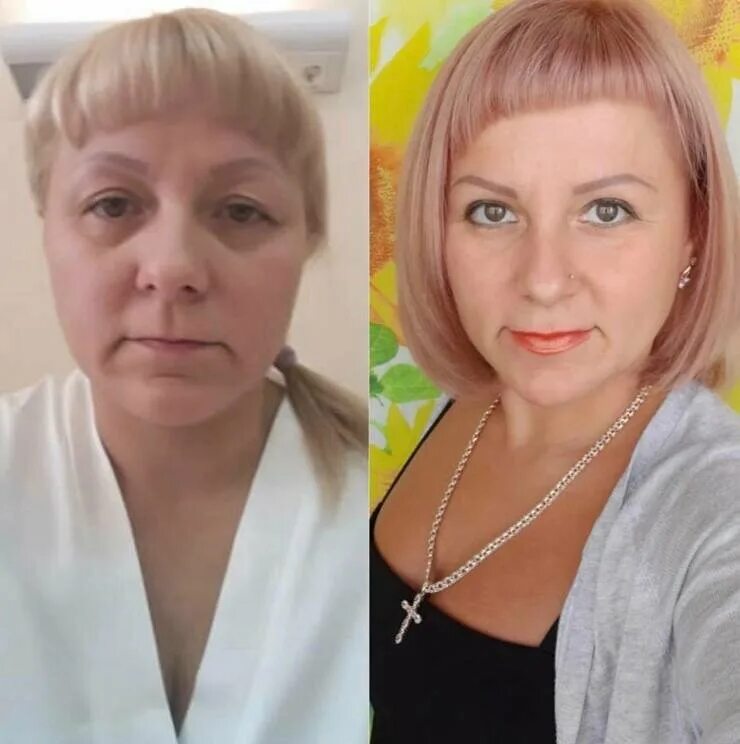 георгий карапетян пластический хирург. тата карапетян до и после пластики. карапетян георгий эдуардович пластический хирург. доктор карапетян пластический хирург. карапетян юрий эдуардович врач.