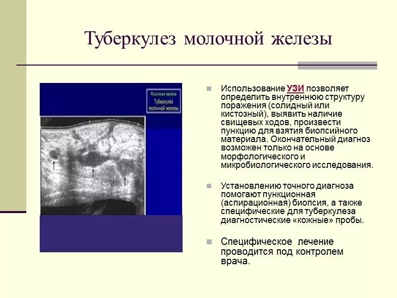 Туберкулез молочной. Олеогранулёма молочной железы УЗИ. Туберкулез молочных желез. Туберкулез молочной железы УЗИ. Остеонекроз молочной железы.