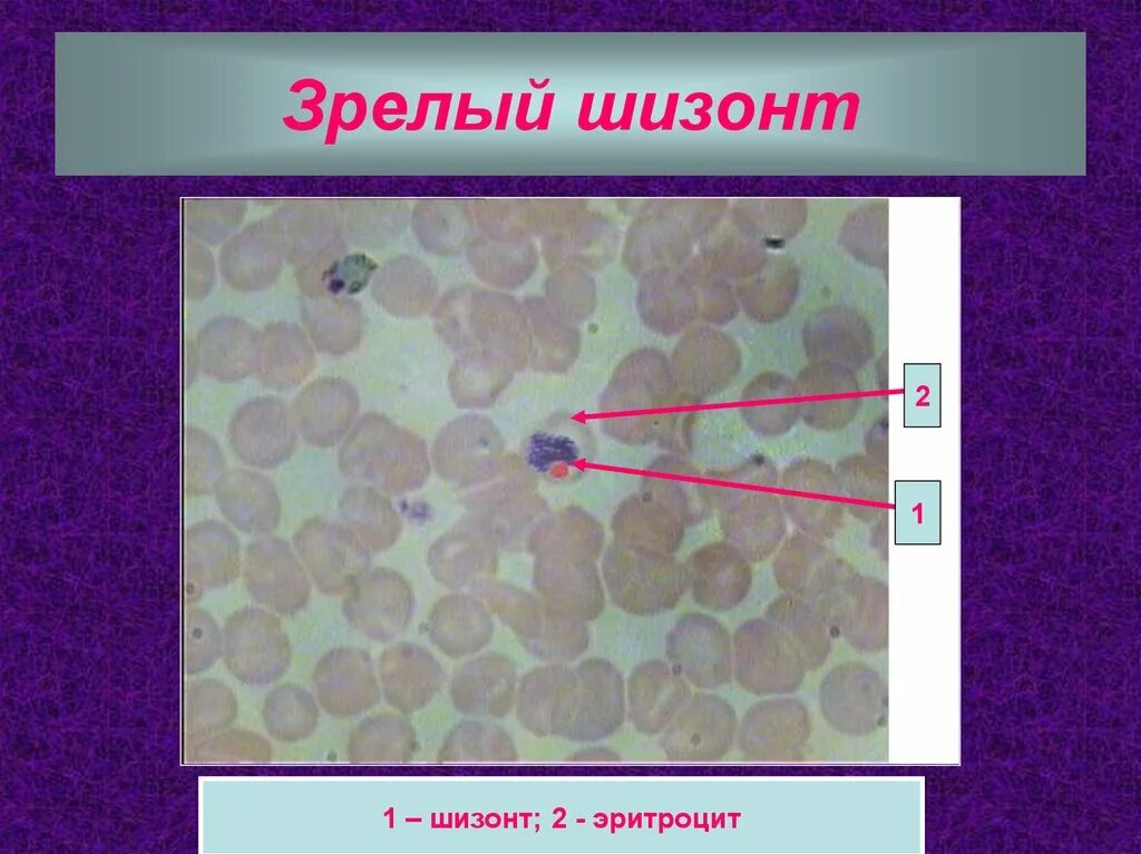 Шизонт. Эритроцитарные шизонты. Шизонты в эритроцитах. Шизонт тканевой это. Шизонт это