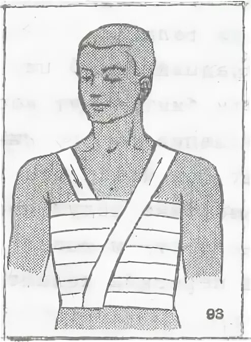 Техника наложения повязок на грудную клетку