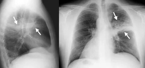 Әйелі секс үшін HD