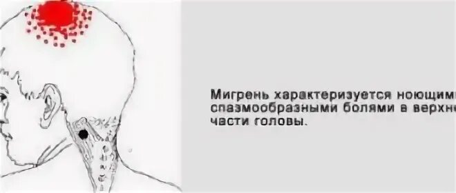 Болит макушка головы