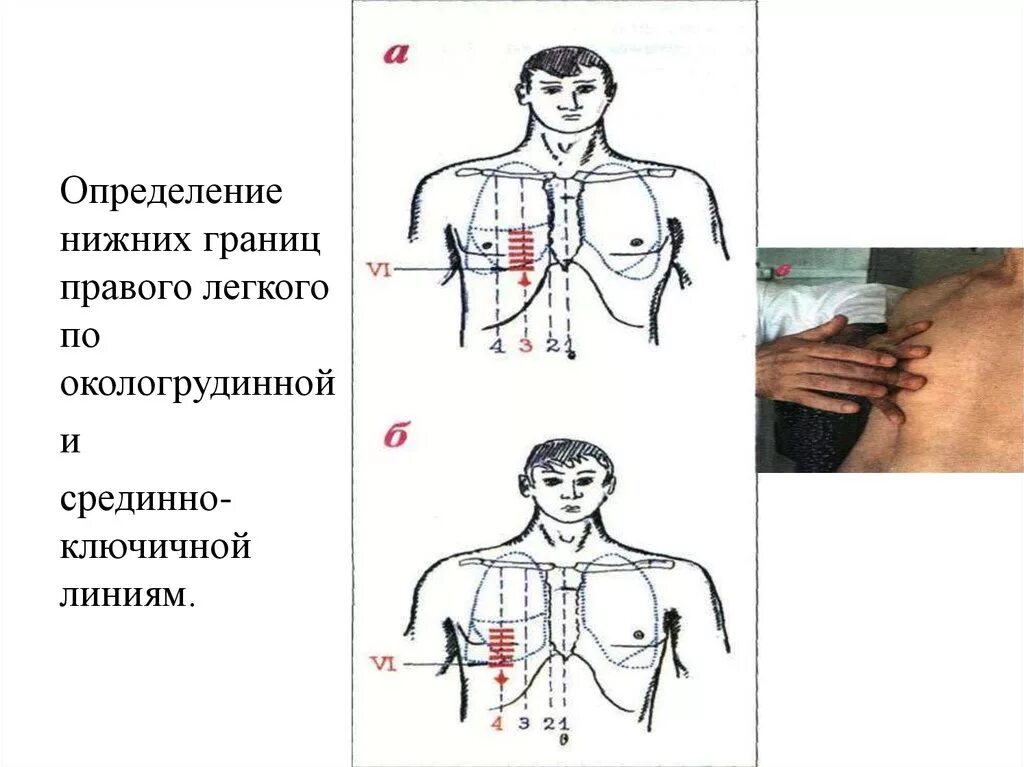 Топографические линии для определения нижней границы легких. Определение нижних границ легких. Перкуссия Нижнего края легких. Нижняя граница легких перкуссия.