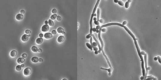 Candida albicans полукол. Дрожжеподобные грибы: псевдомицелий. candida albicans под микроскопом. грибок кандида под микроскопом.
