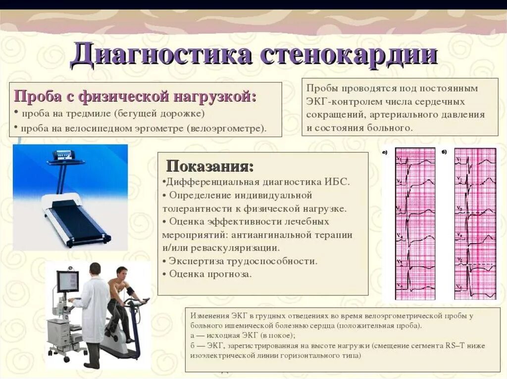 Диагностика стенокардии. Диагностик стенокардии. Проба с физическо йнагру ЭКГ. Пробы с нагрузкой ЭКГ. Нагрузочное экг