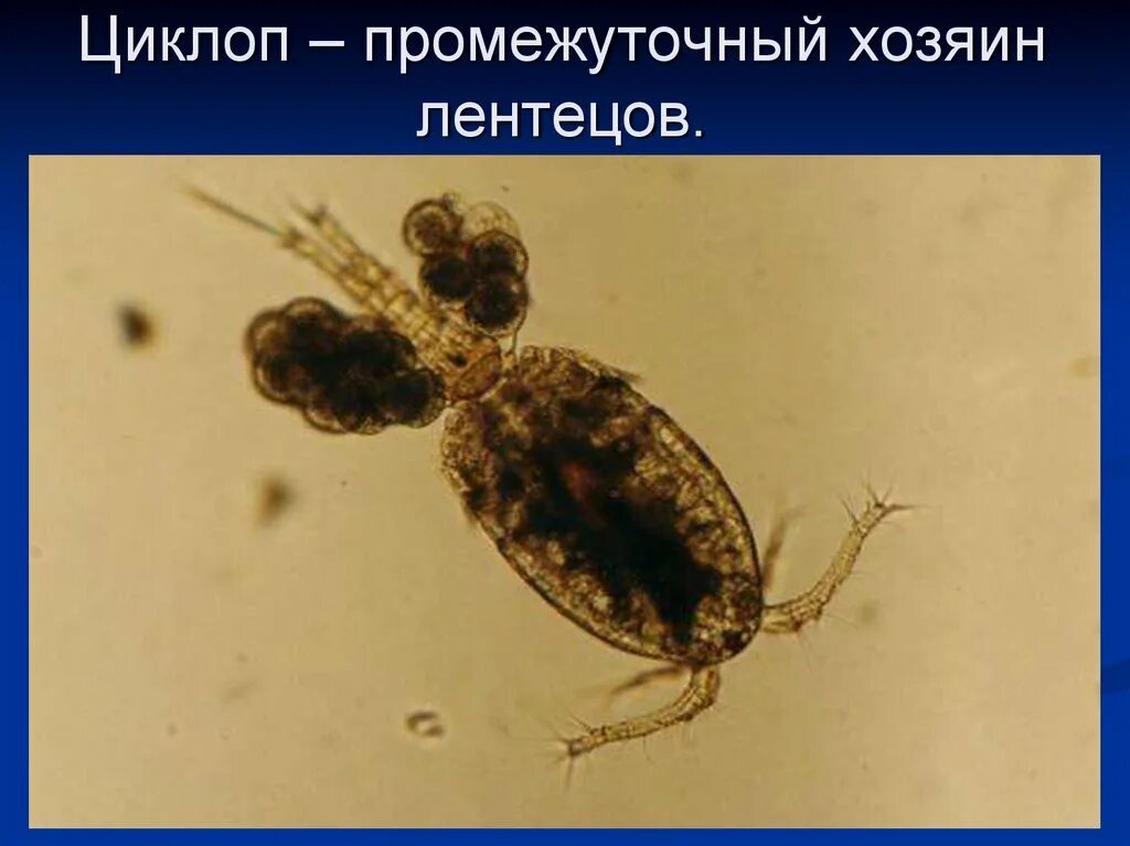 Кровеносная система дафнии. Первый промежуточный хозяин. Ленточные черви широкий лентец жизненный цикл. Циклоп ракообразные. Циклоп промежуточный хозяин.