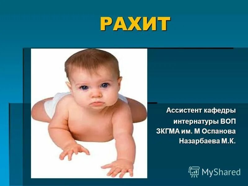 Рахит курсовая работа. Детский рахит презентация.
