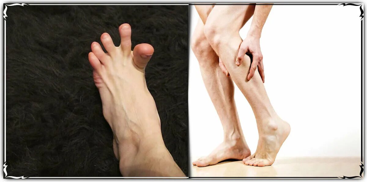 Боль в икрах ног причины у мужчин. Напряженные ноги.