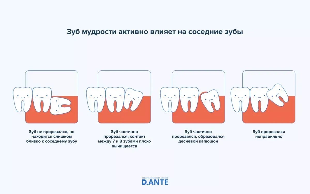 Как долго растут зубы мудрости