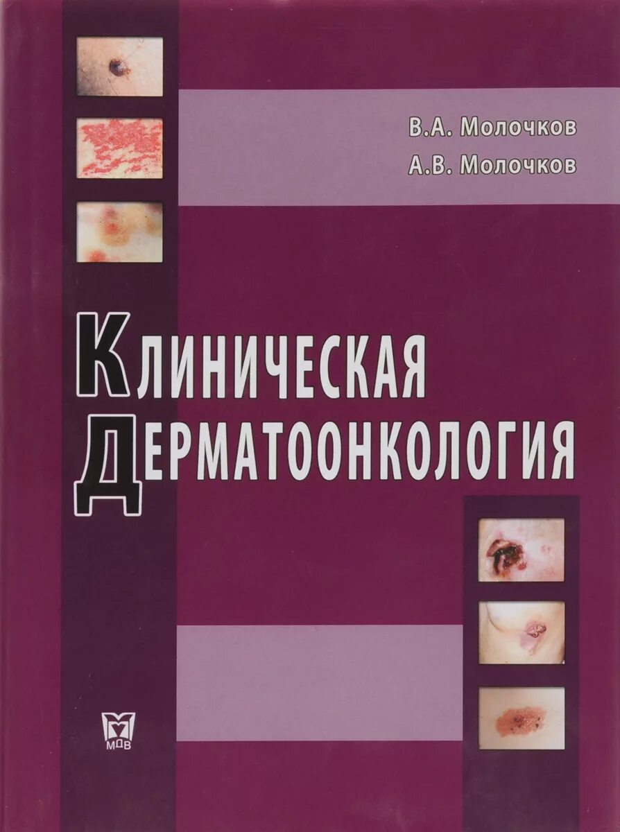 протокол терапии. атлас справочник по дерматологии. дерматовенерология учебник. клиническая дерматовенерология. клинические рекомендации дерматология.