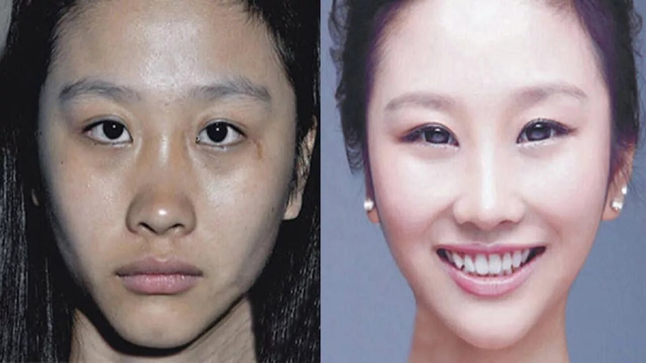 Износ азиатов. Типичная корейская внешность. Японцы до и после пластики. Типичное корейское лицо. Разрез глаз у азиатов.