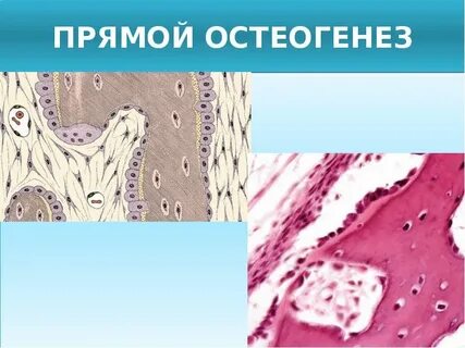 Остеогенез