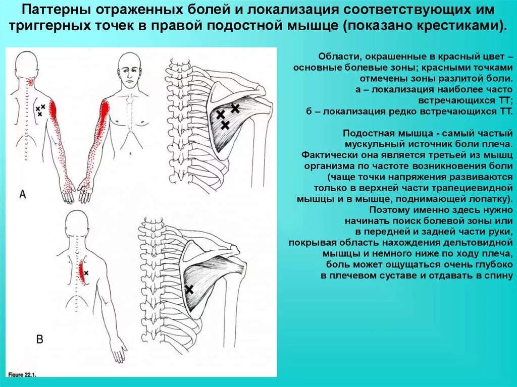 Мышцы паттерны