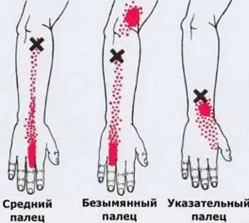 Почему точки на руке