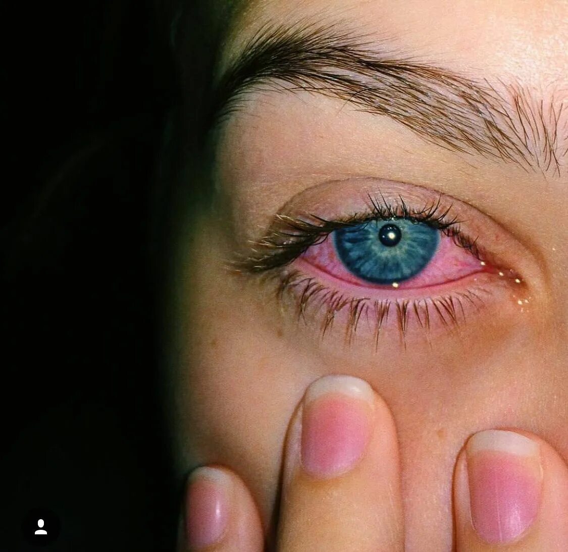 Отслойка сетчатки глаза. Горизонтальные зрачки. Красивые радужки глаз. Eye high. Глаз человека.