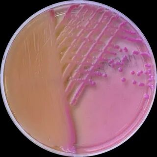 Klebsiella oxytoca