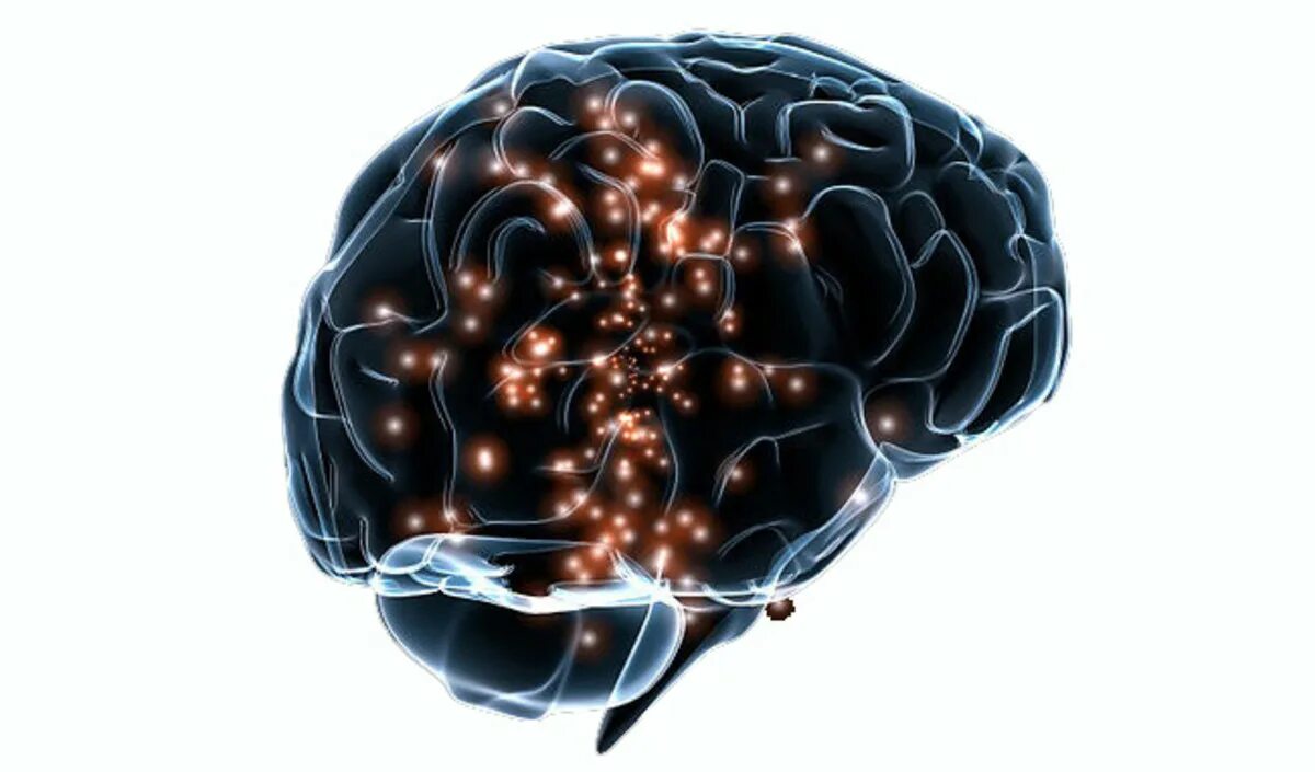 Скорость импульса мозга. Электрический мозг. Электрические мозги. Активность мозга. Клетки мозга.