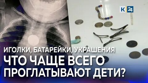 Ребенок съел от обуви