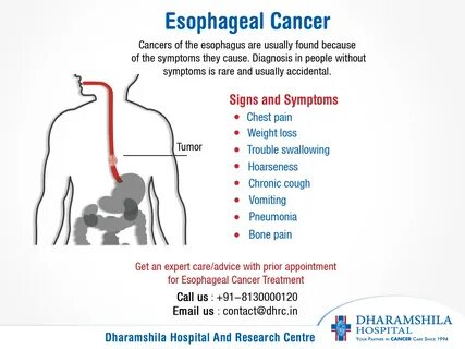 Esophageal cancer