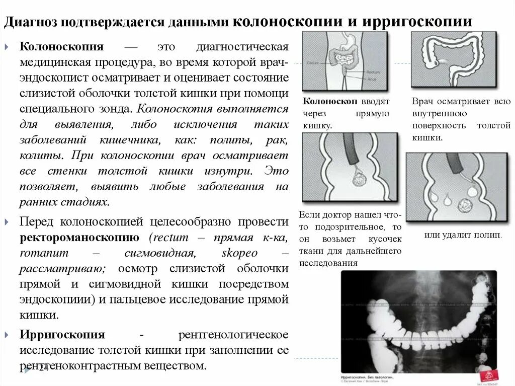 Исследование прямой и сигмовидной кишки. Колоноскопиярригоскопия. Ирригоскопия колоноскопия. Ректороманоскопия ирригоскопия колоноскопия. Ирригоскопия результат исследования.