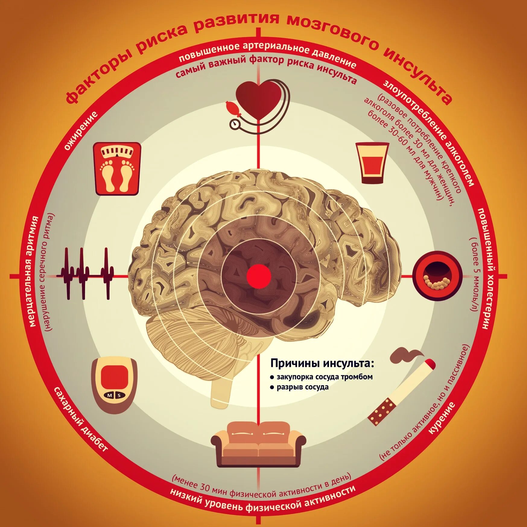 Причины развития мозга. Факторы риска развития мозгового инсульта. Факторы риска острого нарушения мозгового кровообращения. Факторы риска инсульта головного мозга. Факторы возникновения инсульта.
