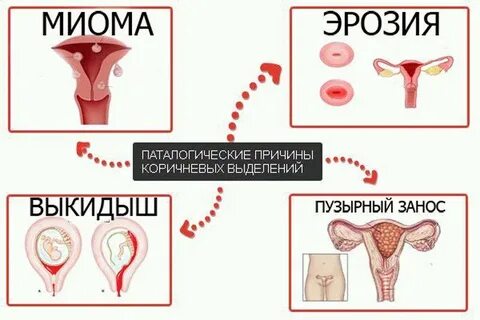 Почему выделения при беременности на ранних